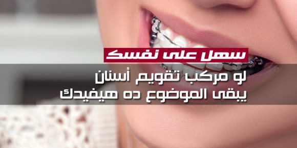 سهل على نفسك.. لو مركب تقويم أسنان يبقى الموضوع ده هيفيدك (إنفوجراف)