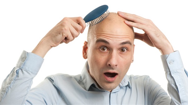 افضل الخلطات الطبعية لمعالجة الصلع الوراثي  