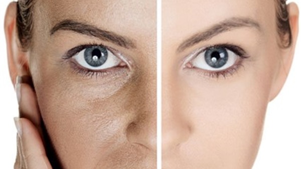 طرق سهلة لتضييق مسام الوجه الواسعة  