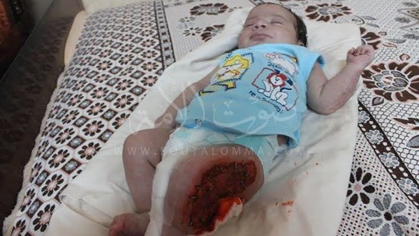 شاهد.. أول فيديو لـ «رضيع المنوفية» ضحية الأهمال  