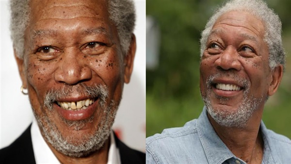 بالصور.. أسنان المشاهير قبل وبعد  عمليات التجميل 