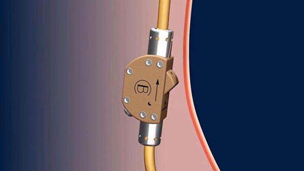 «الصمام» و«الجيل».. أحدث موانع الحمل للرجال