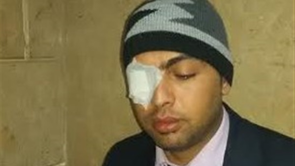 مواطن وزوجته يعتدون بالضرب على محامي بالدقهلية