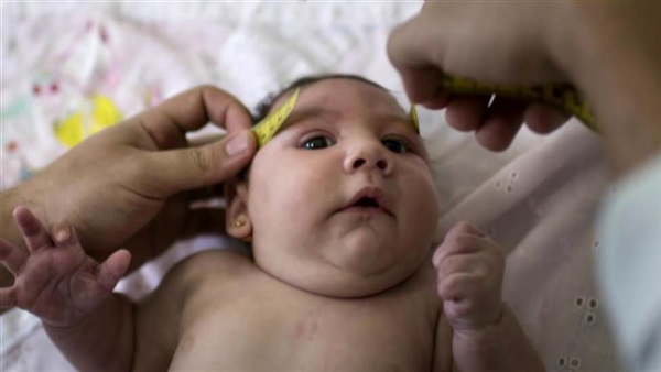 33 مليون شخص ضحية فيرس «زيكا».. تقارير الأمم المتحدة تطالب برفع ميزانية الطوارىء لـ 300 مليون دولار.. تشوهات خلقية في الرأس أبرز علامات المرض.. «نقابة الأطباء»: «مصر آمنة»