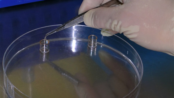 تطوير أدمغة مصغرة باستخدام خلايا بشرية