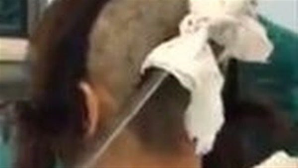 بالفيديو.. سيدة تشق رأس زوجها بالساطور