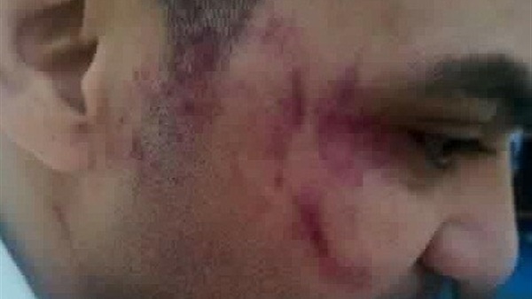 القبض على أشقاء النائب الأردني المتهمين بسحل عامل مصري  