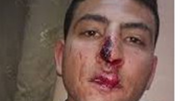 الاعتداء على المحامي محمد سامح بجامعة عين شمس