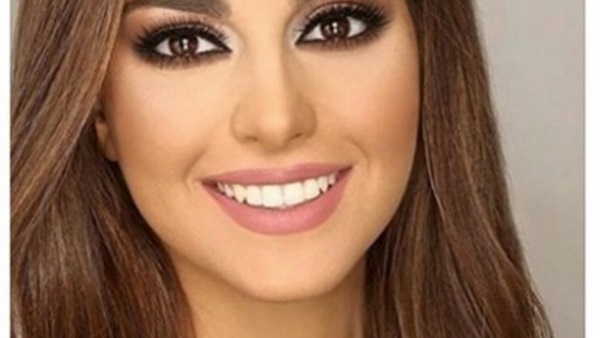 بالصور.. ملكة جمال لبنان تحصل على لقب أجمل وجهه فى العالم 