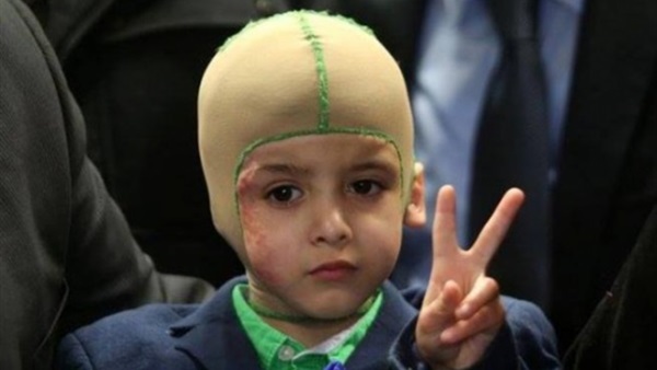 وزير الصحة اللبناني يعرض علاج «الدوابشة» في بيروت