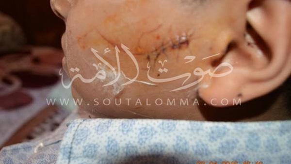 بالصور.. حبس ولى أمر مزق جسد زميل إبنه ببورسعيد