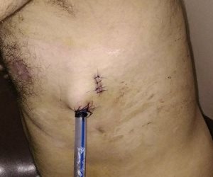 نجل مسئول يستغل أزمة أصحاب الكافيهات ويسدد طعنتين لـ«صاحب كافية» بالهرم (مستندات)