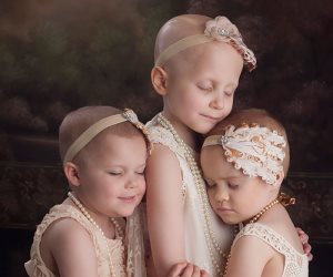 مصور يجمع 3 صغيرات فى جلسات تصوير قبل وبعد علاج السرطان.. شوف الضحكة  