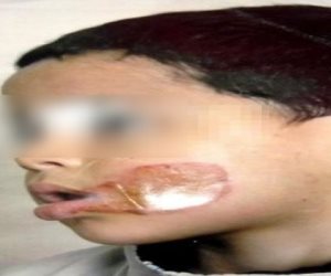 خلافات بين شخصين تتسبب في تشويه طفل بالمرج