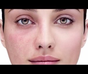 تعرفى على مشروب سحرى يخلصك من الالتهابات ويساعدك على شفاء الجروح لأسرتك