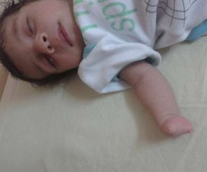 الطفل محمد ولد بدون أصابع بيده اليمنى ..ووالدته :نفسى يسافر ألمانيا يتعالج