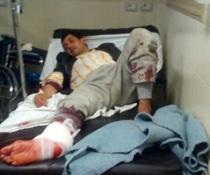 ننشر صور للمصابين في حادث تفجير الكنيسة المرقسية بالإسكندرية بالمستشفى الميري