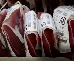 تعديل أسعار أكياس الدم لمرضى العلاج بالأجر بمستشفيات الإسكندرية الجامعية