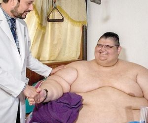 أسمن رجل فى العالم يخضع لبرنامج تدريبى ونظام غذائى بعد جراحه ناجحة بالمكسيك