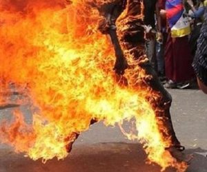 ومن اللعب ما قتل.. طفل يحرق زميله بالبنزين في الدقهلية