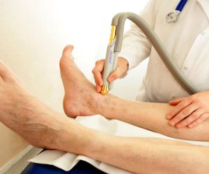 دراسة تؤكد إصابة القدمين بمشاكل صحية وجلدية بسبب "الشبشب"