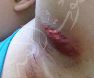 عمه وراء الحادث.. مصرع طفل في الخصوص بعد احتجازه وتعذيبه بواسطة «كلب»