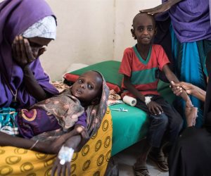 20 مليونا يواجهون المجاعة بسبب الحرب فى اليمن والصومال وجنوب السودان ونيجيريا
