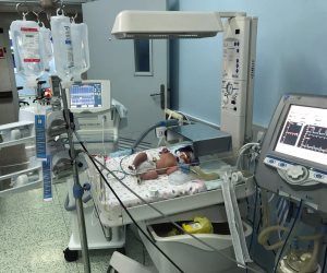 جهاز لتبريد المخ بالمستشفى التعليمي بجامعة طنطا لحماية حديثي الولادة من ضمور الخلايا (صور)