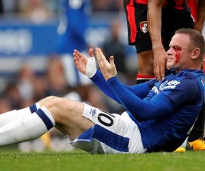 واين روني يتعرض لإصابة مروعة في مباراة إيفرتون و بورنموث (صورة)