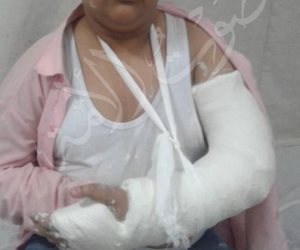 "بالزمزمية والشلوت" معلم يكسر ذراع طالب في سوهاج (صور)
