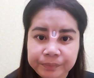 بلاش الرخيص والمراكز المجهولة.. نصيحة سيدة تايلاندية فشلت عملية تجميل أنفها