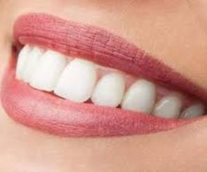 أبرز 5 شائعات موروثة مهلكة للأسنان