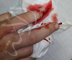بعد نشر صوت الأمة.. «تعليم الجيزة» تقرر استبعاد مدير مدرسة «عقلة الإصبع»