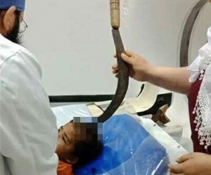 فريق طبي ينجح فى إنقاذ حياة طفل دخل في رأسه «منجل» زراعي بدمياط (صورة)