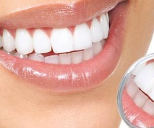 الصحة تعلن تفاصيل أسباب وراء اصفرار الأسنان