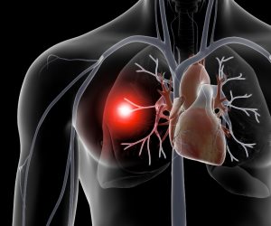 تعرف على أعراض الإصابة بالجلطة الحادة في القلب.. تكشفها وزارة الصحة