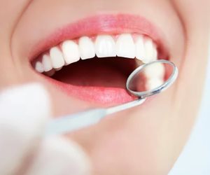 "هتضحك وتبين سنانك".. طريقة سحرية بتدابير منزلية تخلصك من إصفرار الأسنان