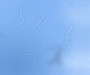 كل ما تريد معرفته عن النقاط والأشكال الصغيرة التى نراها عند النظر لأشعة الشمس