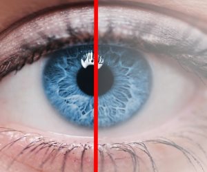 المياه البيضاء على العين تؤدي لفقدان البصر.. ما هي طرق الوقاية منها؟