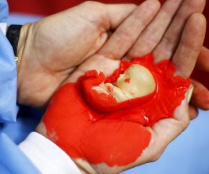 بعد موافقة البرلمان الأوروبي.. تكريس الحق في الإجهاض يثير الجدل عالميا