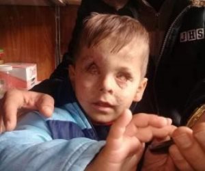 «جمعة».. طفل عمره 3 سنوات سرق «أردوغان» بصره وقتل أسرته 