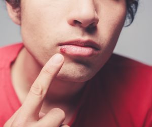 علاقة قروح الفم أو الأعضاء التناسلية بأعراض الهربس 