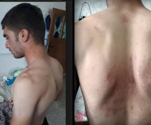 سجون أردوغان سلخانات تعذيب.. واقعة انتهاك جديدة لحقوق الإنسان في تركيا