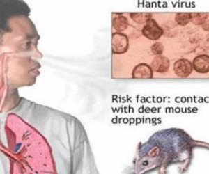 كل ما تريد معرفته عن فيروس هانتا الصيني 