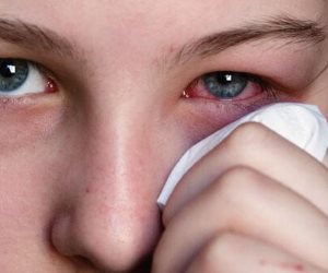اعرف أسباب الشعور بالألم في زاوية العين.. أهمها التهاب الجفن
