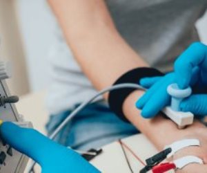 اعرف اختبار سرعة التوصيل العصبى NCV.. والأمراض التى يكشف عنها 