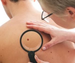 لماذا تحافظ لقاحات سرطان الجلد على استجابتها المناعية بالجسم بعد سنوات من الحقن؟