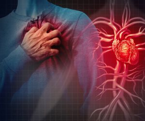  أسباب ألازمات القلبية المفاجئة وأعراضها.. تعرف عليها
