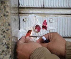في حملات لإدارة العلاج الحر .. الصحة تعلن غلق 1422 منشأة خاصة لمخالفتها اشتراطات مكافحة العدوى والعمل دون ترخيص 