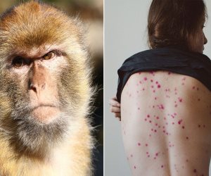 عدم وجود إصابات .. الصحة تكشف عن الوضع الوبائى لفيروس جدرى القرود فى مصر                                                             